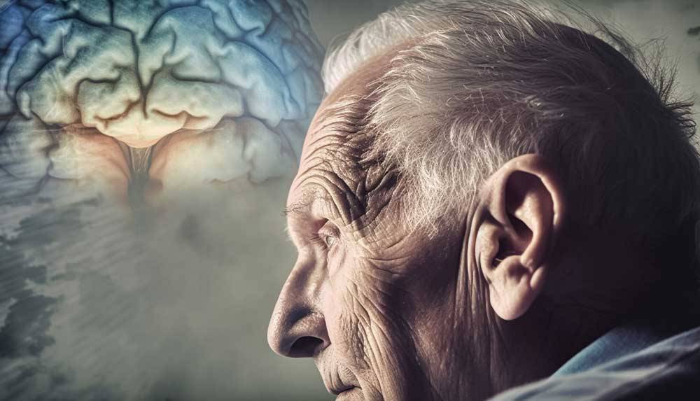 ¿Qué es el alzhéimer y cómo atenderlo?