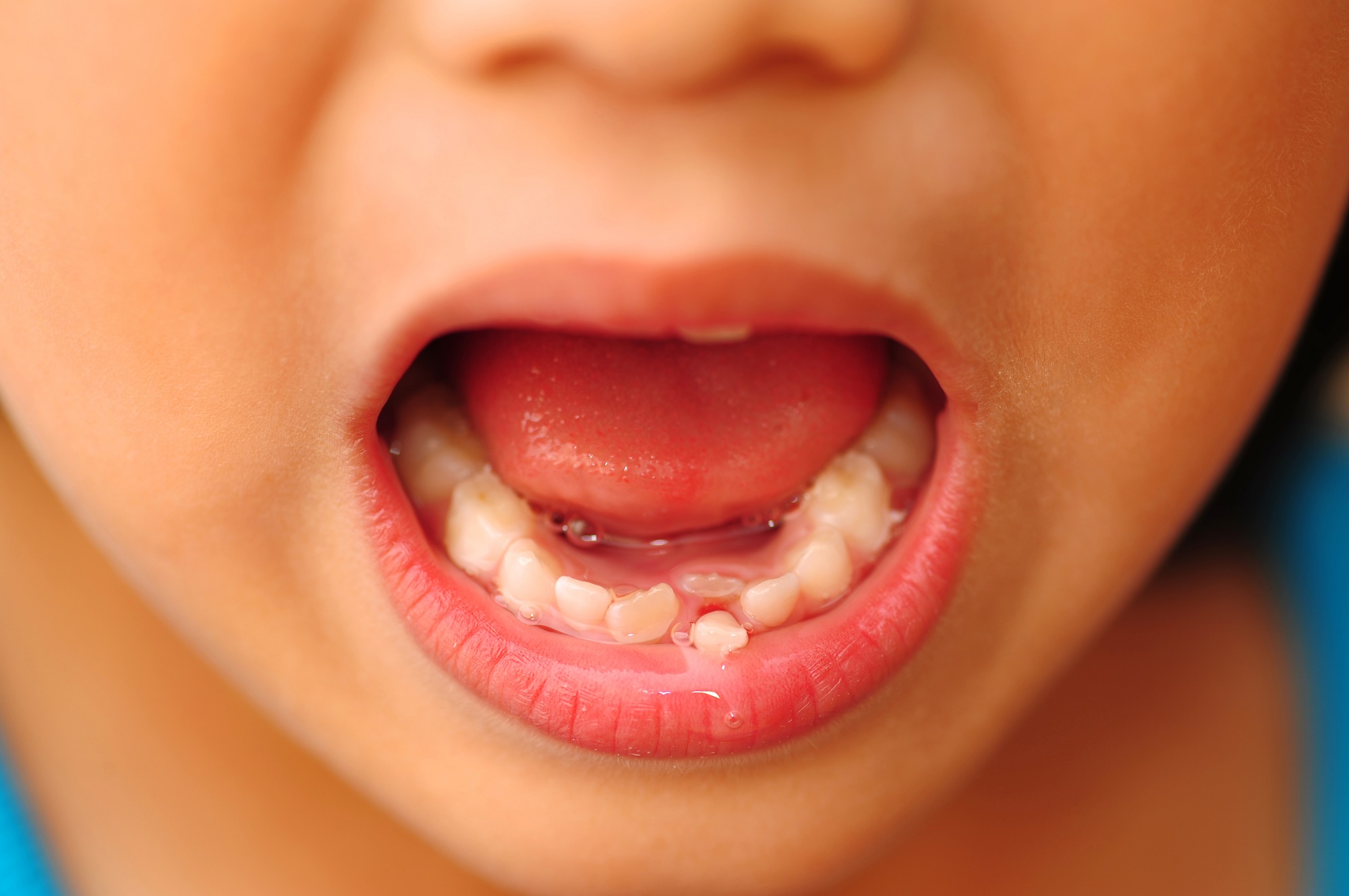 ¿Por qué son importantes los dientes de leche?